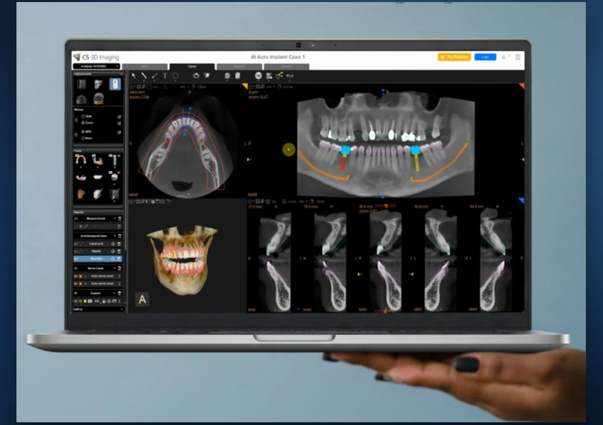 Software de imagiologia dentária 3D num portátil — do exame ao plano de tratamento