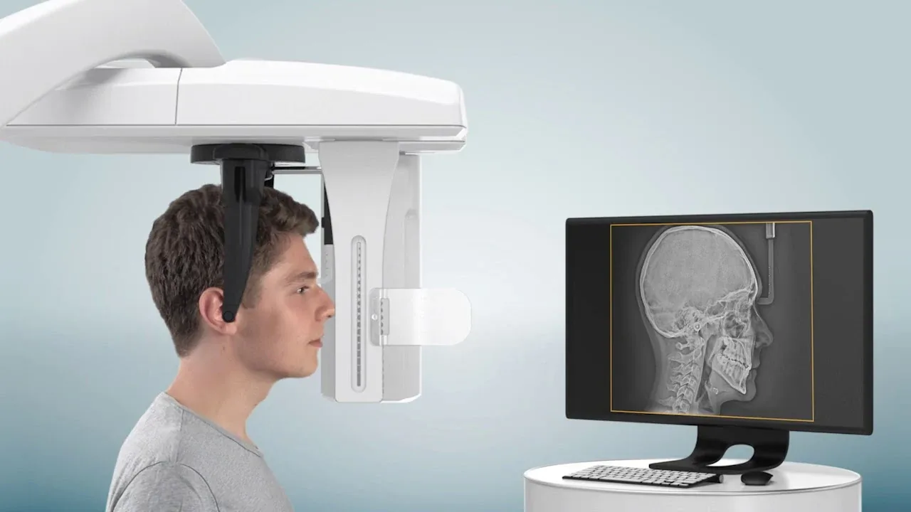 Telerradiografia de perfil digital na clínica Lusocare de Alcochete